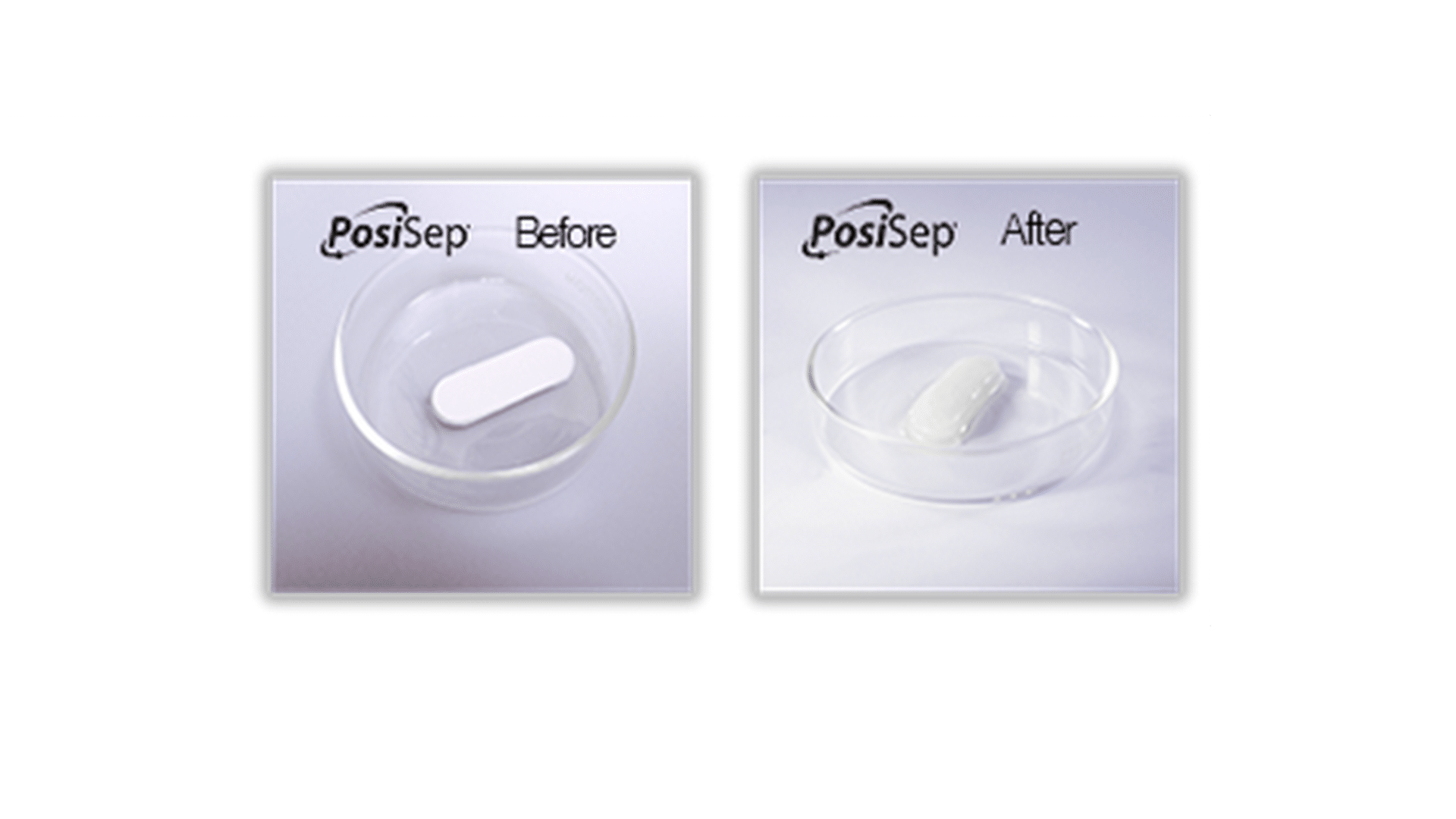 PosiSep® Comes as a firm sponge and turns into a gel after placement in the sinus cavity and hydration with saline or moisture in the sinus.